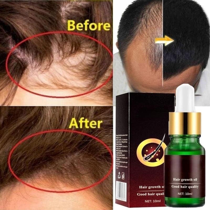 Ginseng Olaj Haj Növekedési Eszköz Eredeti hajhullás Termékek, Mellékhatások nélkül Gyorsabban Nő a Haj Regrowth Termékek
